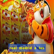 real madrid x las palmas escala??o