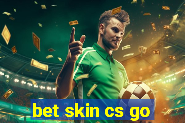 bet skin cs go