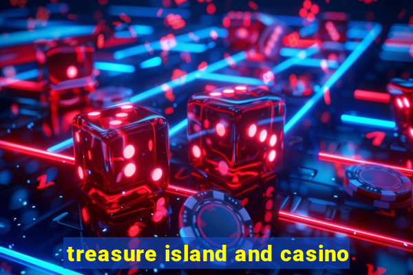 treasure island and casino