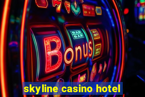 skyline casino hotel